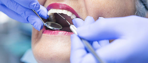 Best Emergency Wisdom Tooth Extraction in Rothschild, WI